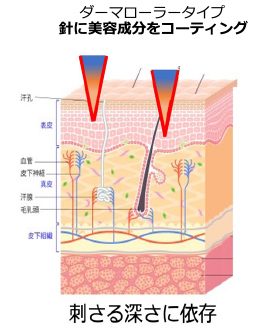 ダーマローラータイプ