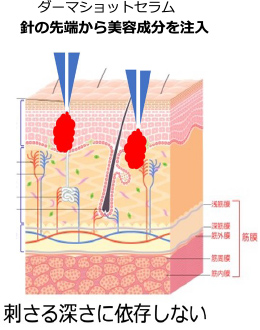 ダーマショットセラム
