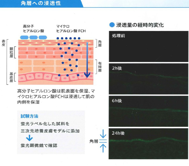 マイクロヒアルロン酸FCH