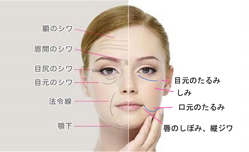 肌の老化と部分的なお悩み
